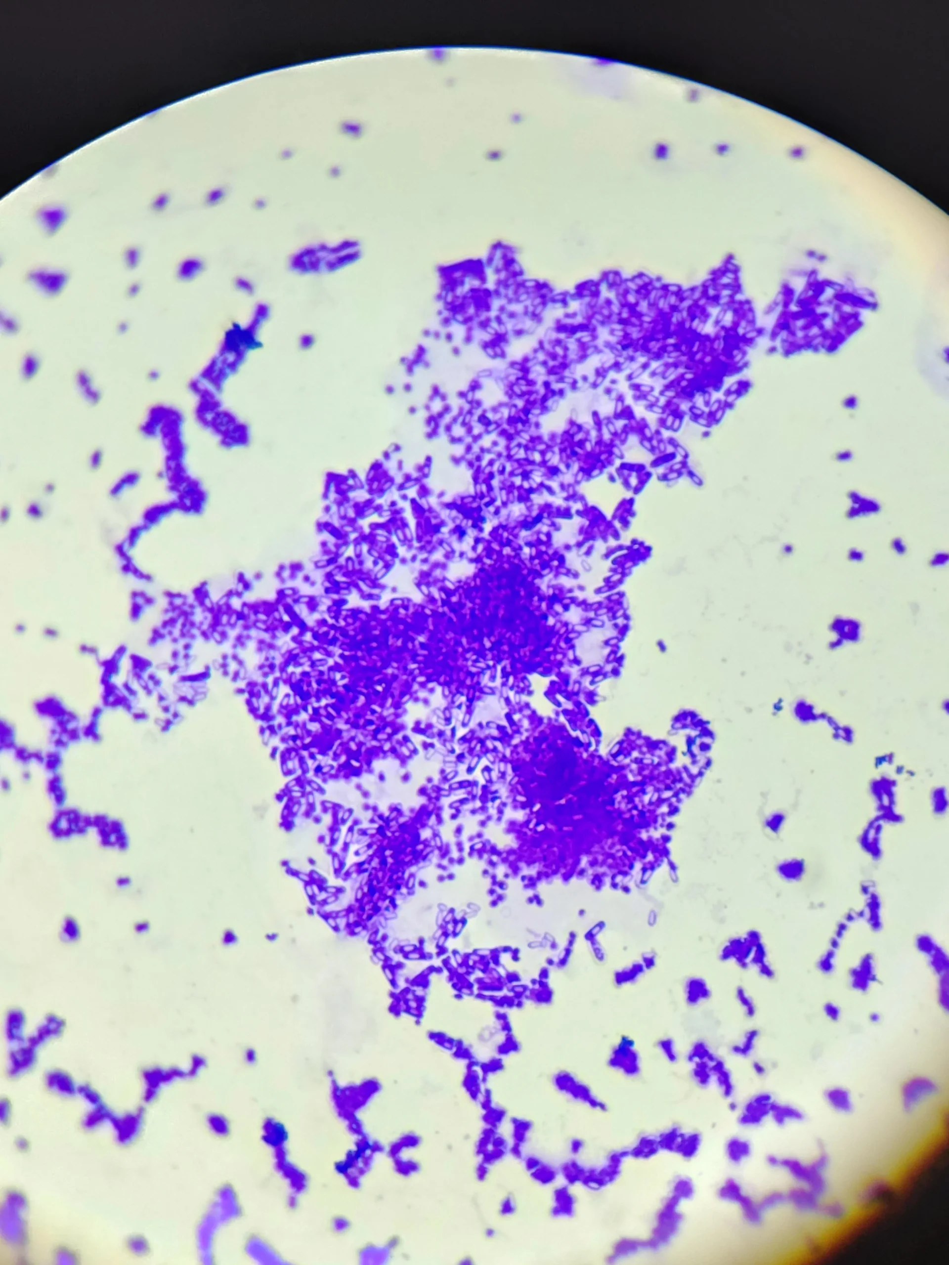 bactérias em carne crua microscopia